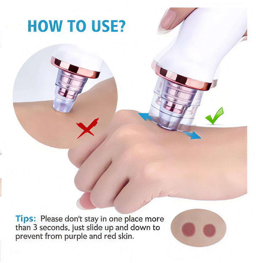 Vacuum Blackhead Remover Face Black Spots Cleaner White Dot Pimple Removal